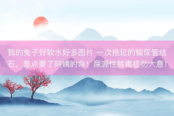 我的兔子好软水好多图片 一次拖延的输尿管结石,差点要了阿姨的命!尿源性脓毒症勿大意!